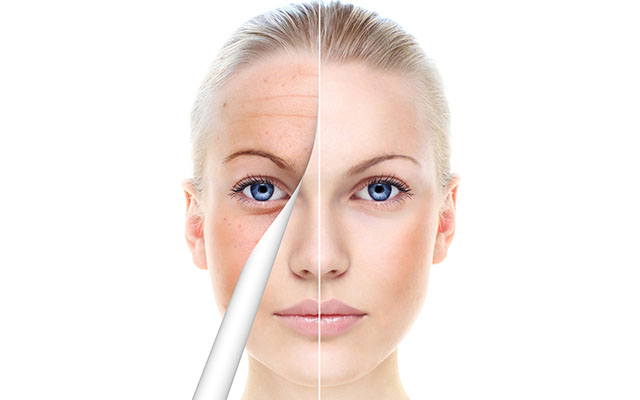 美白에 대한 이미지 검색결과