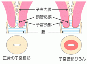 妊娠初期で鮮血の出血があった場合はどんな時 Hachibachi