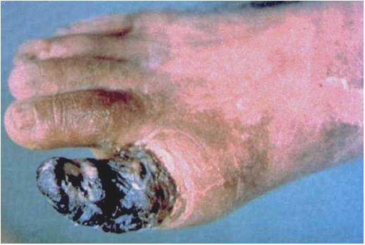 ニコチン,害에 대한 이미지 검색결과