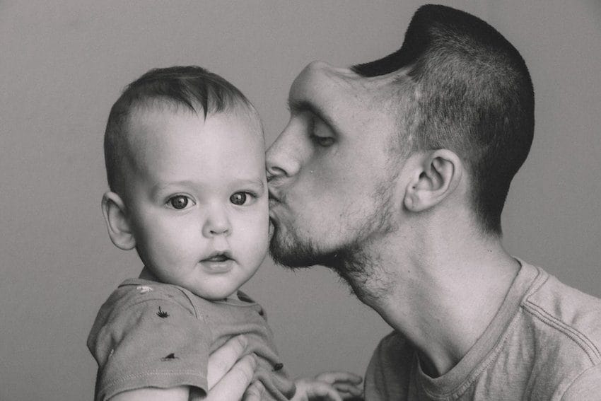 energy-drinks-casues-brain-hemorrhage-5