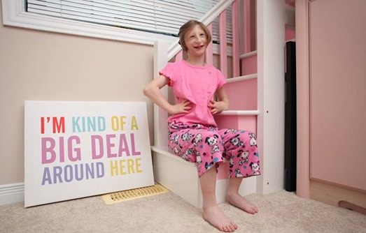 kenadie-dwarfism-2