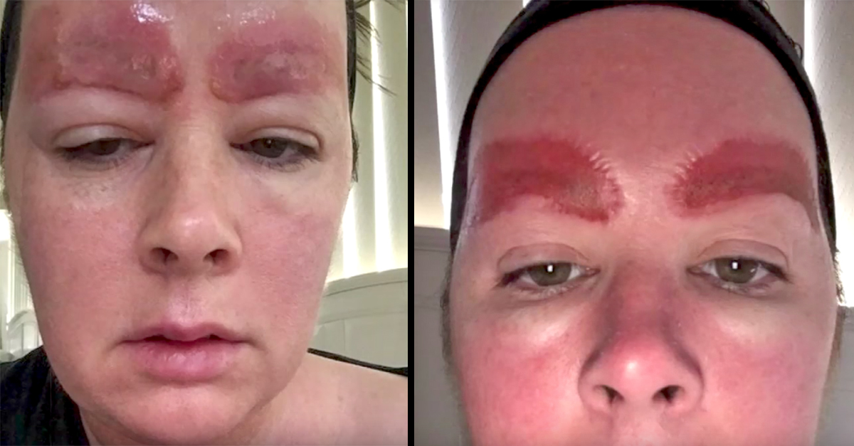 microbladding-gone-wrong