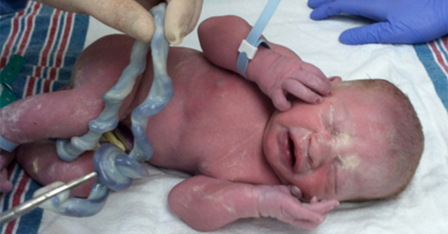 Image result for azathothfrog