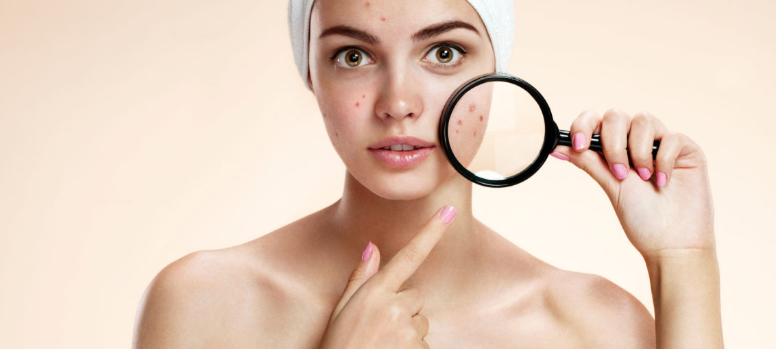 38215087 - photos of ugly problem skin girl on beige background