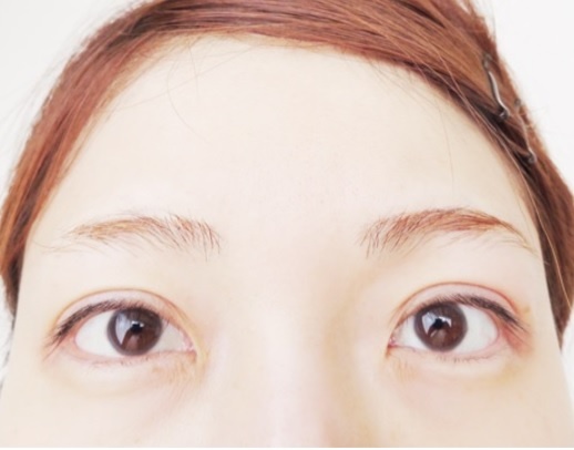 Image result for 桃さん　整形