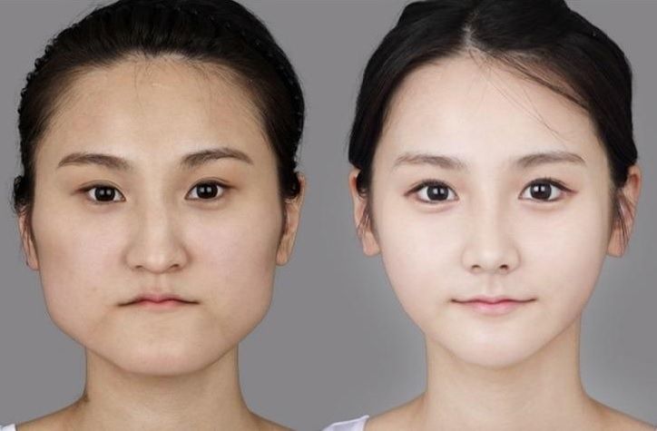 Image result for 韓国人　整形