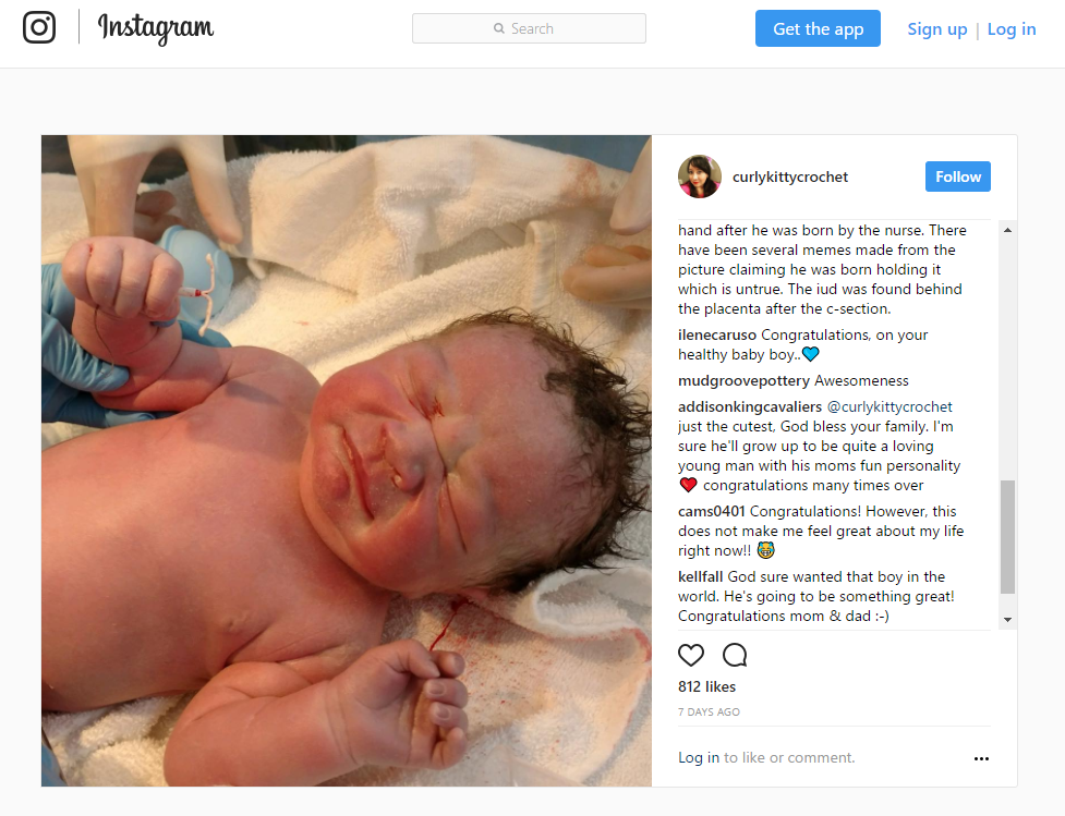 Iud newborn baby에 대한 이미지 검색결과