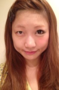 Image result for 桃 二重整形