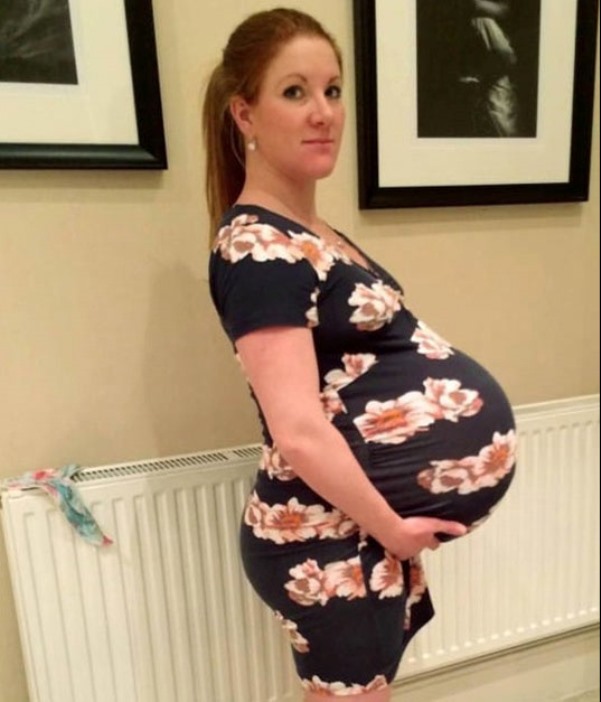 Mom Gave Birth To The Heaviest Twins In The History Of Scotland - Small 