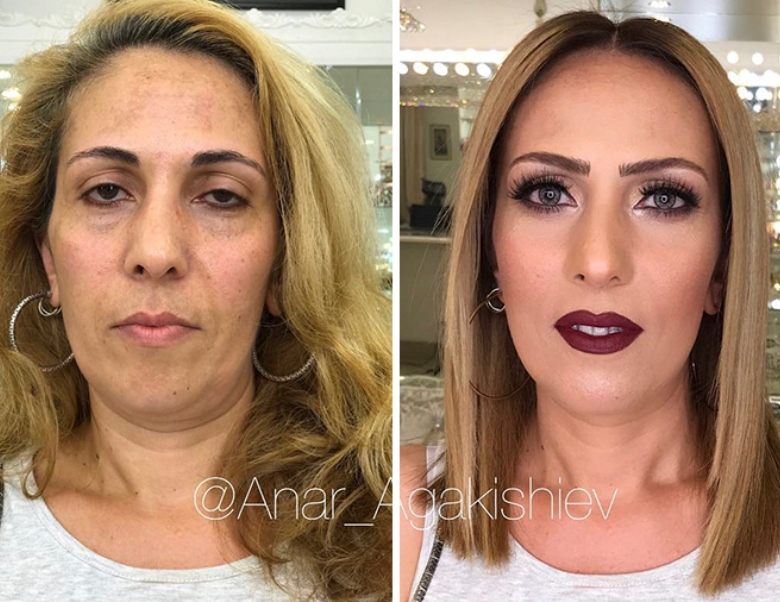 anar6