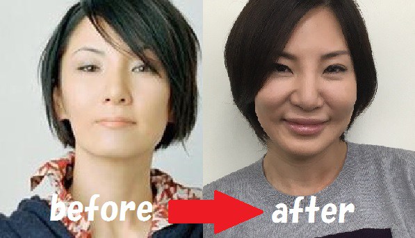 広瀬香美 整形에 대한 이미지 검색결과