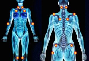 fibromyalgia-_mystery-_solved5