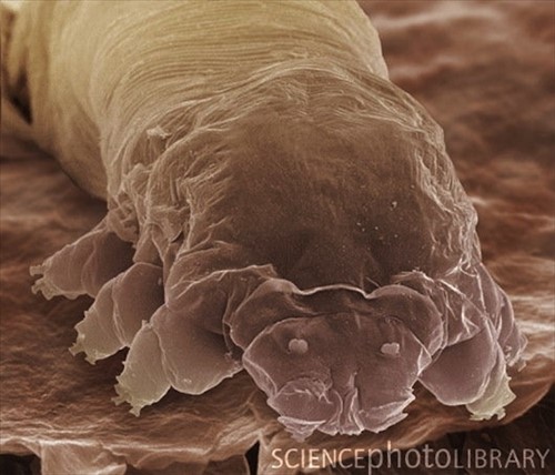 顔ダニ에 대한 이미지 검색결과