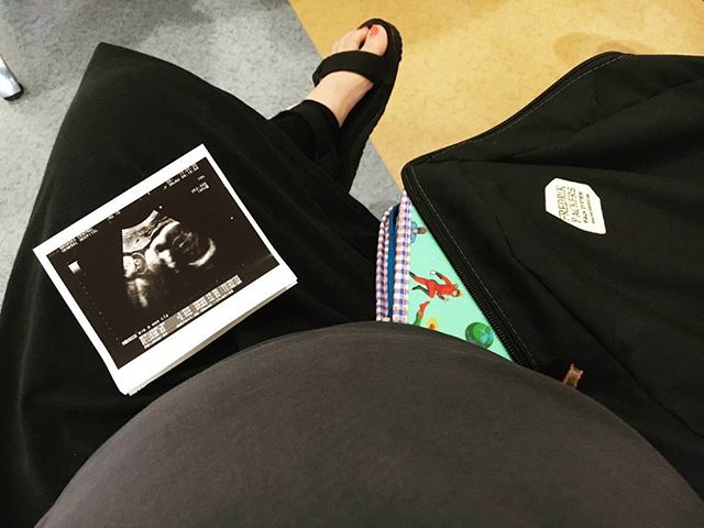 妊娠初期,出血,鮮血,少量에 대한 이미지 검색결과