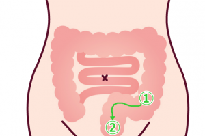 S字　マッサージ에 대한 이미지 검색결과