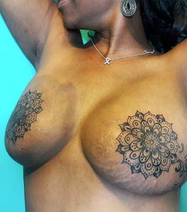 cicatrizes-tatuagem-encoberta-10-590ad3ff6db82__605