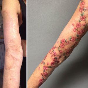 cicatrizes-tatuagem-encoberta-110-590b2c5bf1092__605