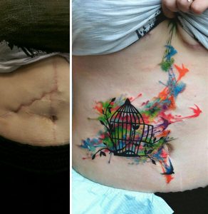 cicatrizes-tatuagem-encoberta-113-590b3988afc9e__605