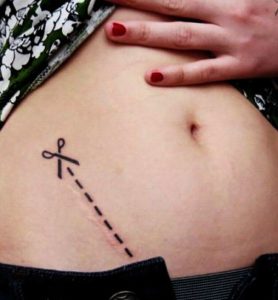 cicatrizes-tatuagem-encoberta-12-590ad4045b294__605