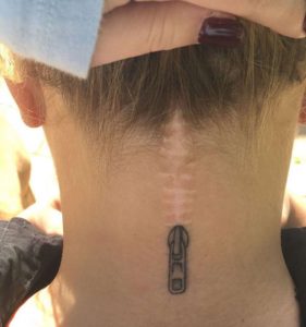 cicatrizes-tatuagem-encoberta-14-590ad408653e2__605