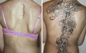 cicatrizes-tatuagem-encoberta-34-590b1c5a29fab__605