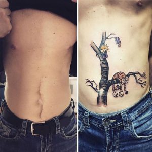 cicatrizes-tatuagem-encoberta-36-590b1cb123359__605