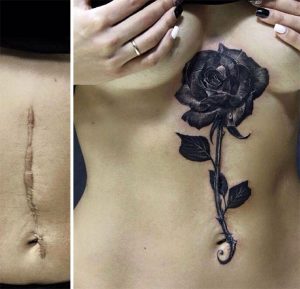 cicatrizes-tatuagem-encoberta-49-590b2a7232b03__605