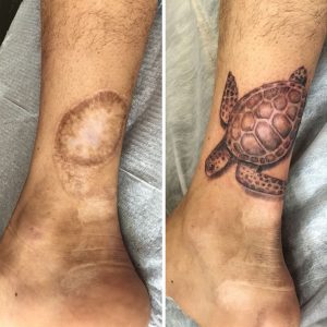 cicatrizes-tatuagem-encoberta-52-590b327f0089a__605