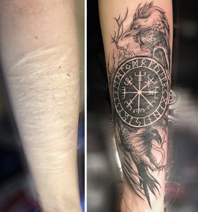 cicatrizes-tatuagem-encoberta-89-590c2d7f6d770__605