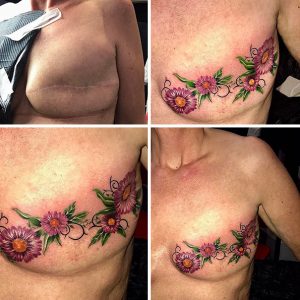 cicatrizes-tatuagem-encoberta-92-590c312dba441__605