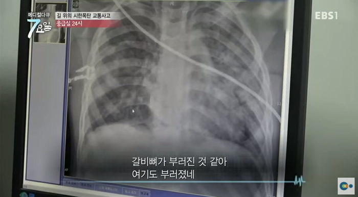 EBS '메디컬다큐-7요일'