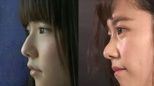 島崎遥香 整形後에 대한 이미지 검색결과