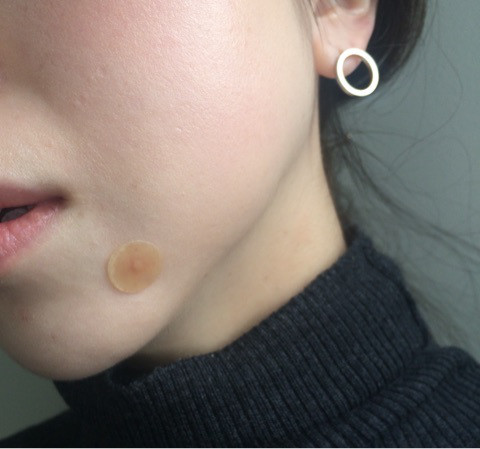 ニキビパッチ에 대한 이미지 검색결과