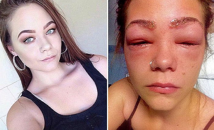 カラーリング　副作用