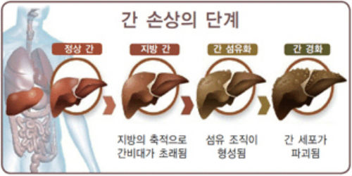 %ea%b0%84%ec%a7%88%ed%99%98