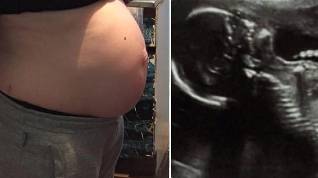 unborn.jpg - Mom Was Told By Doctor She Had Lost Her Baby But It Turns Out To Be False