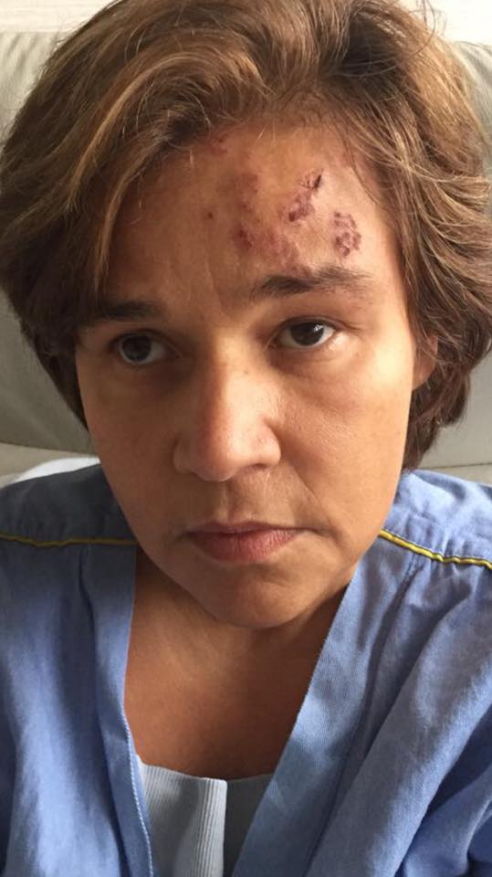 23844635_919558398191148_185883564003729699_n