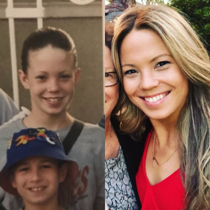 When You Finally Grow Into Your Five Head & Teeth...