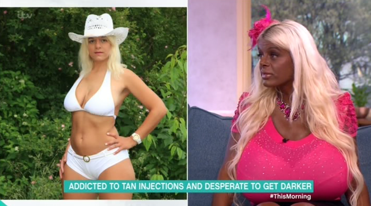 Martina Adam injection에 대한 이미지 검색결과