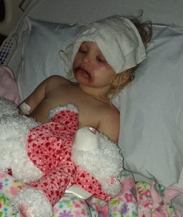  Kylie had to take Lydia to hospital following her alleged reaction