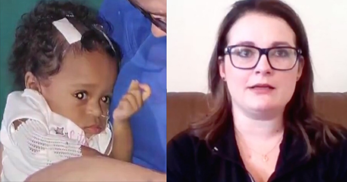 enfermeira-adota-bebê-com-ossos quebrados-3