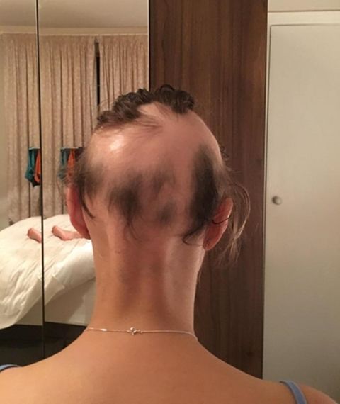 ê²°í¼ ì¤ë¹ ì¤í¸ë ì¤ë¡ ì구 í모 걸린 ì¬ì±