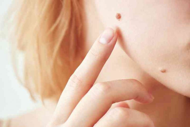 healthy-skin-3