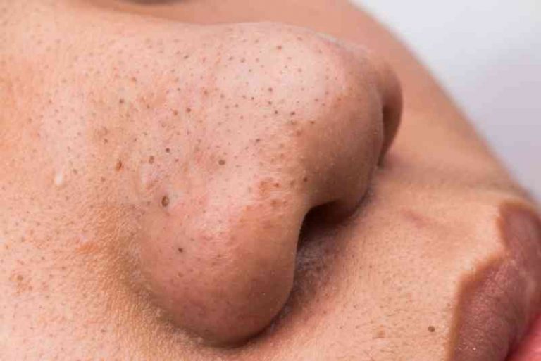 healthy-skin-4