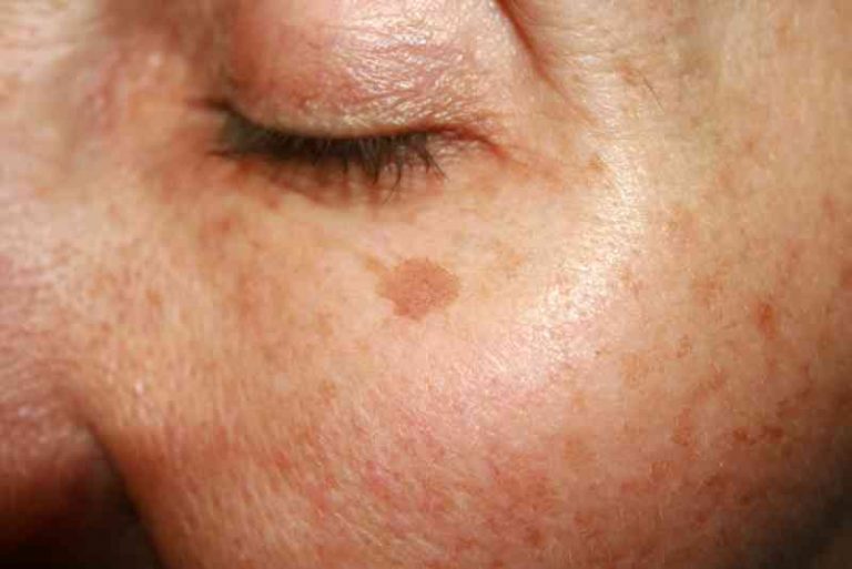 healthy-skin-6