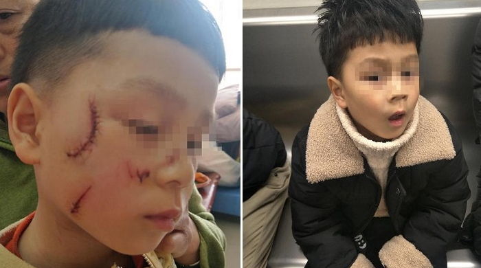 ì¸ì¬ì´í¸