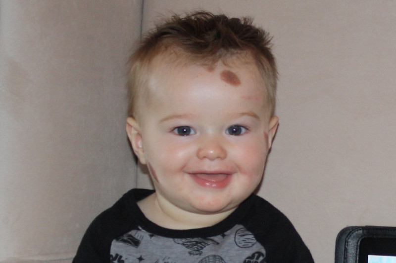 Une mère évite de sortir avec un bébé qui est né avec des taches