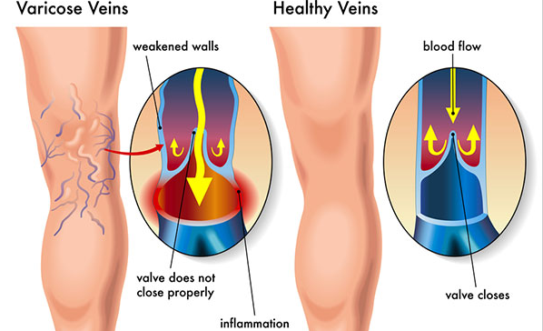 Veins