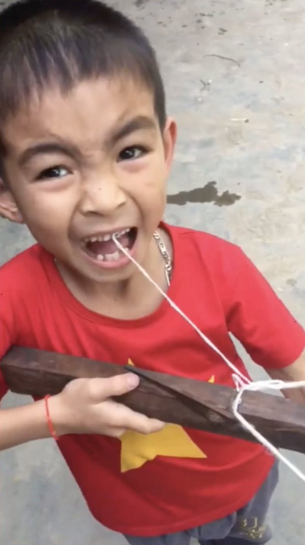 remove teeth crossbowì ëí ì´ë¯¸ì§ ê²ìê²°ê³¼