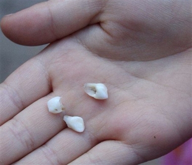 ãæ­¯ãæããå¤¢ãã®ç»åæ¤ç´¢çµæ